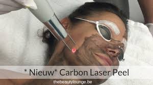 carbon laser peeling behandeling