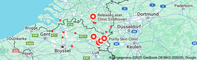 laser ontharen aanbieding