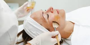 beste chemische peeling