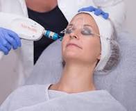 fractional laser behandeling
