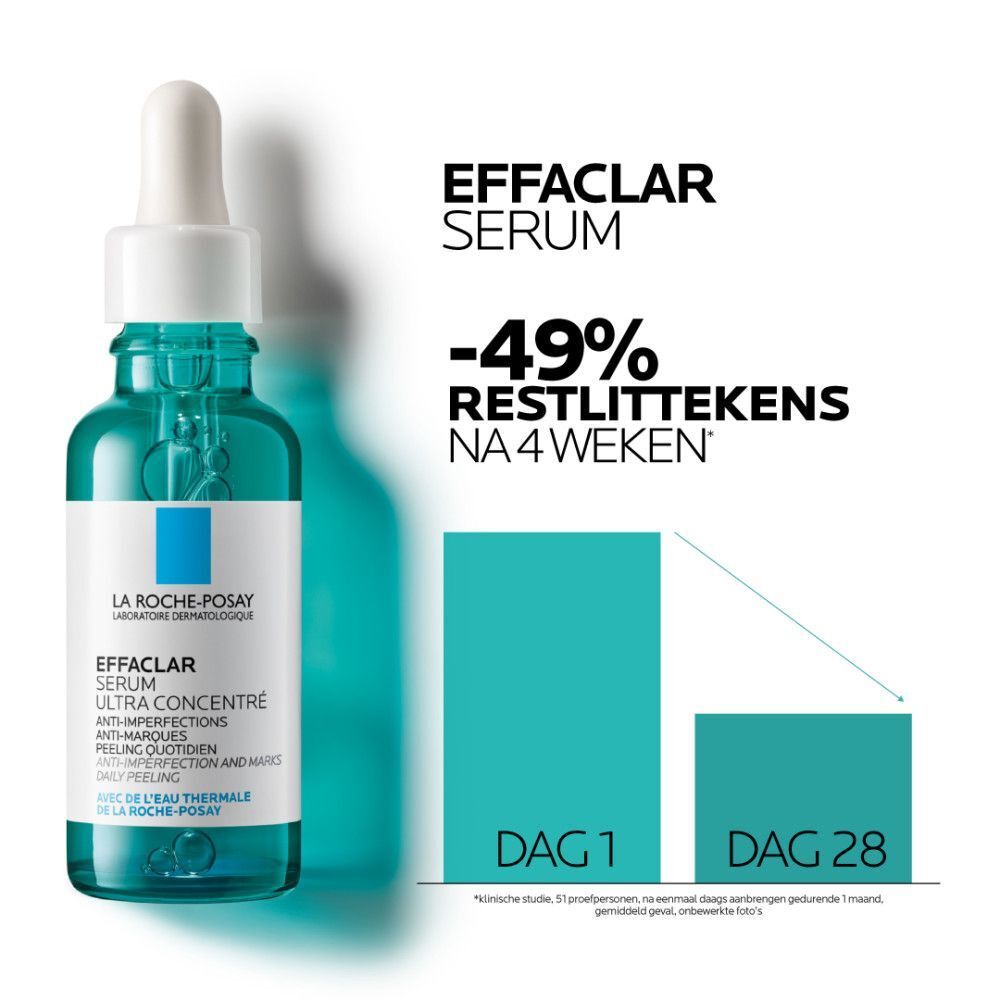 peeling gevoelige huid