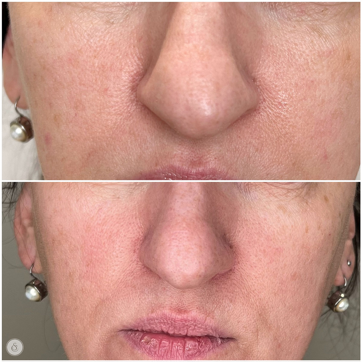 peeling grove porien