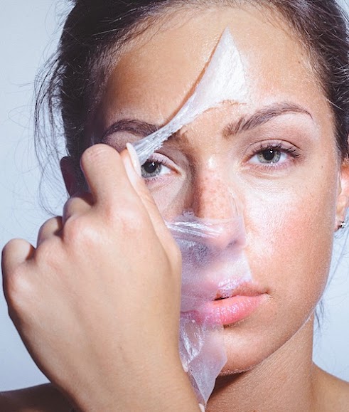 chemische peeling pigmentvlekken