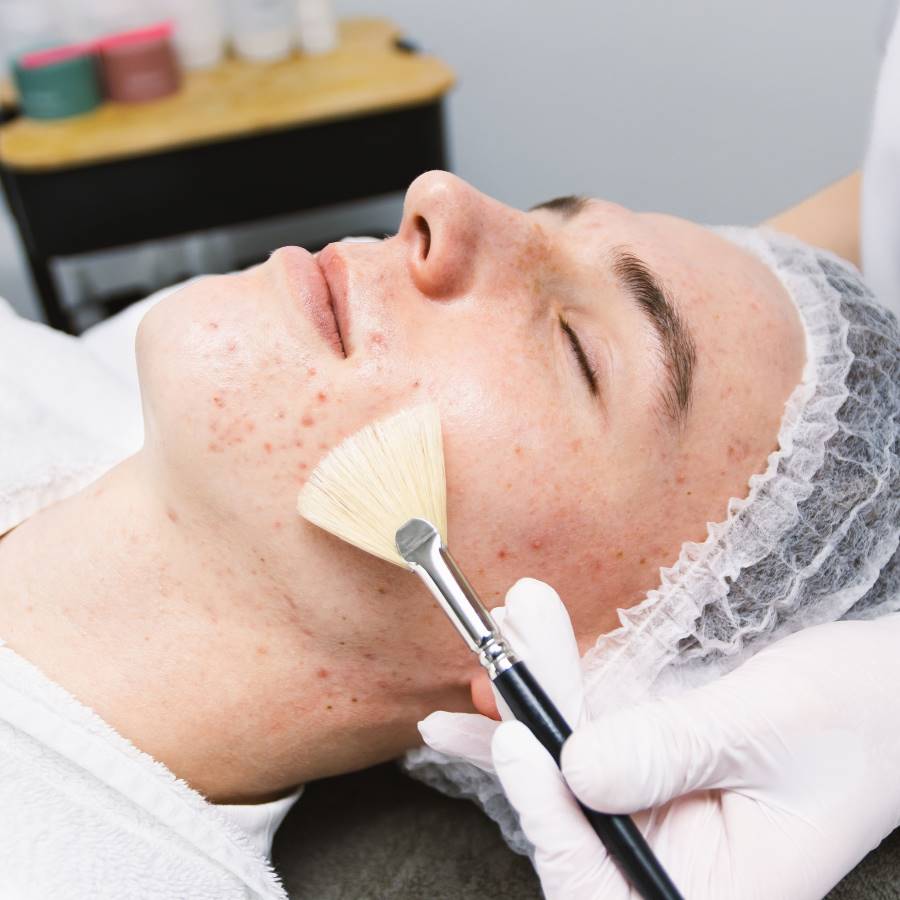 goede peeling voor gezicht