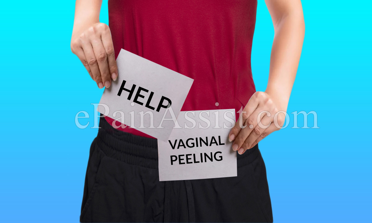 peeling vaginal