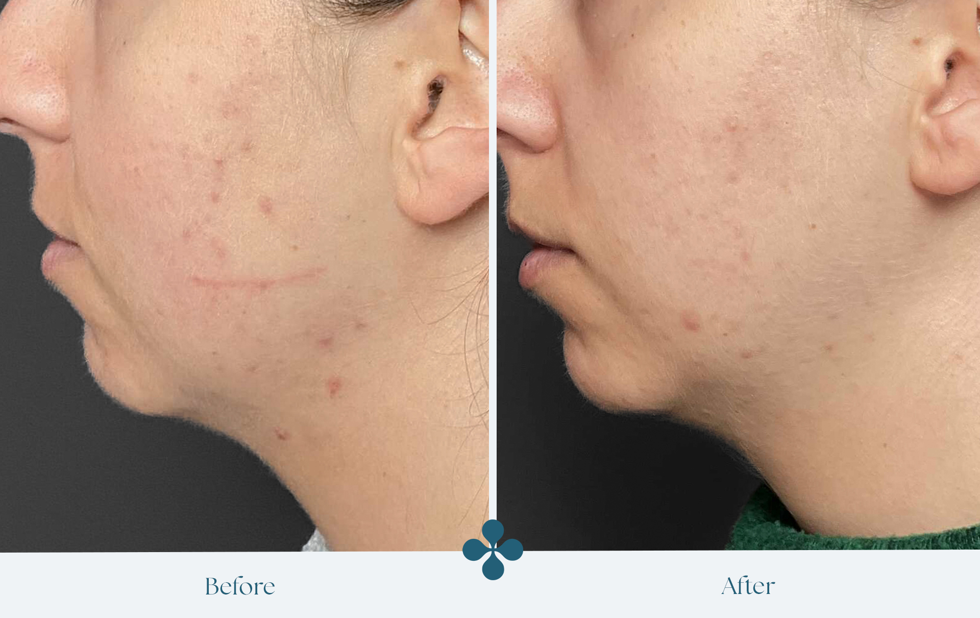 dermamedic kliniek voor huidverbetering en huidzorg