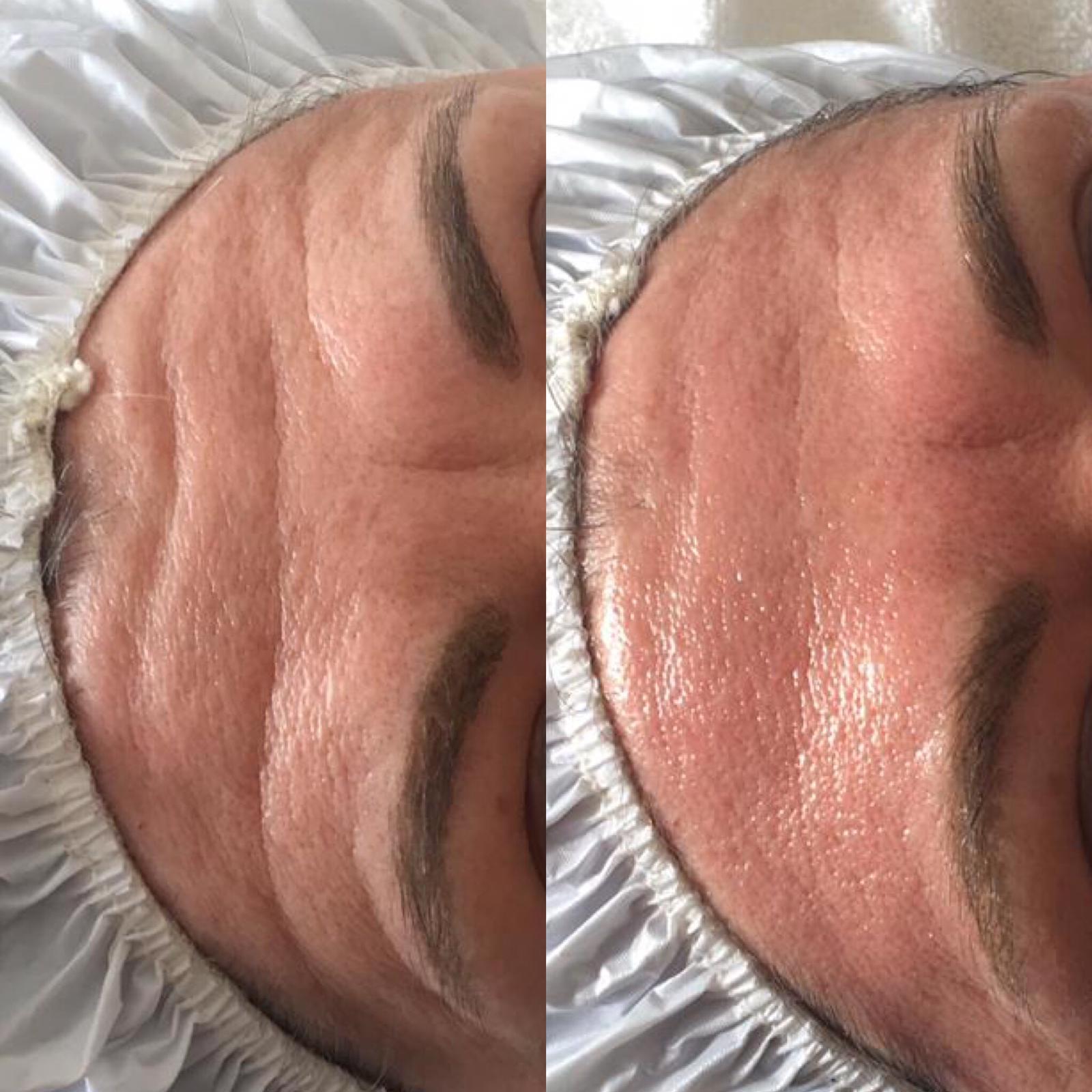 habitat huidverbetering