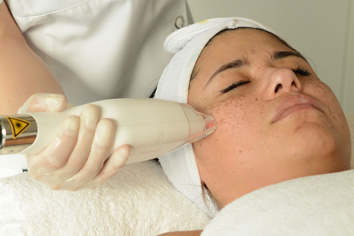 huidverjonging thuis