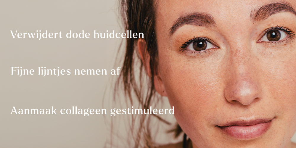 glycolzuurpeeling voor en na