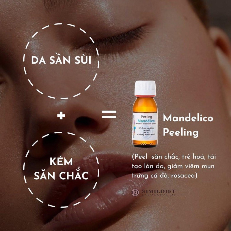 simildiet mandelico peeling