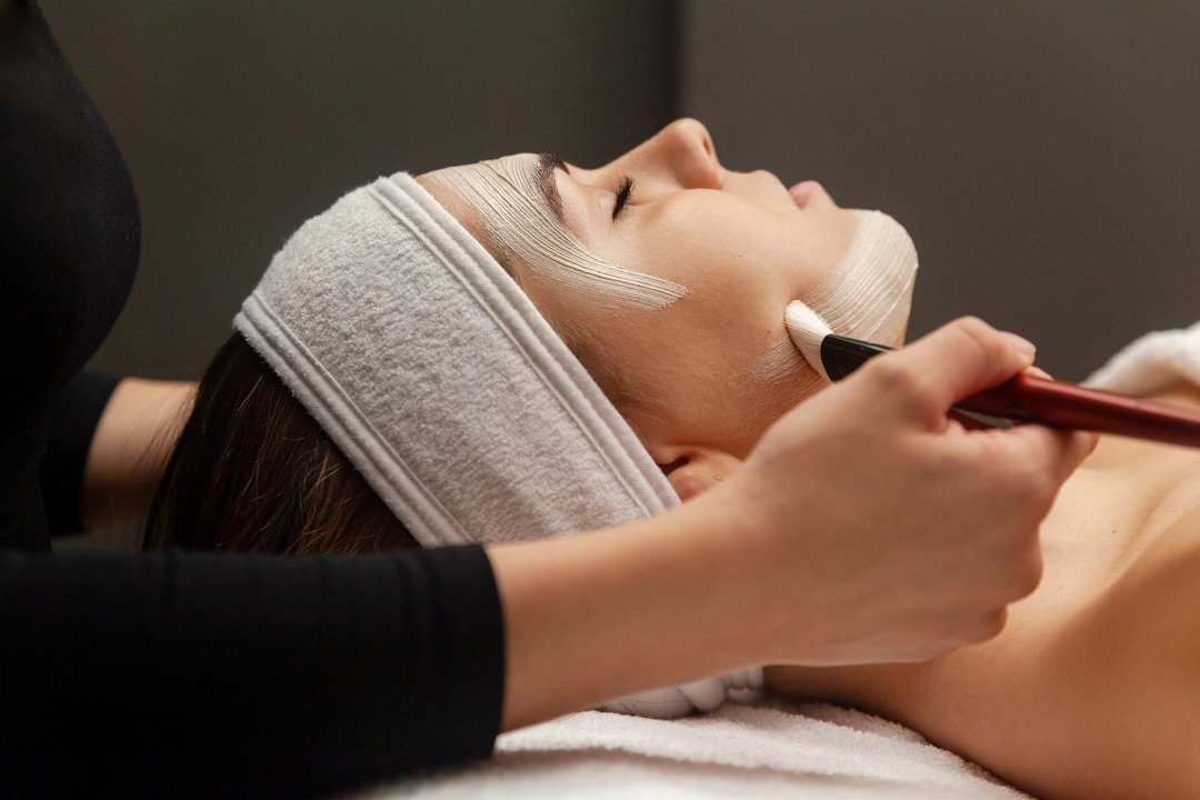 chemische peeling gent