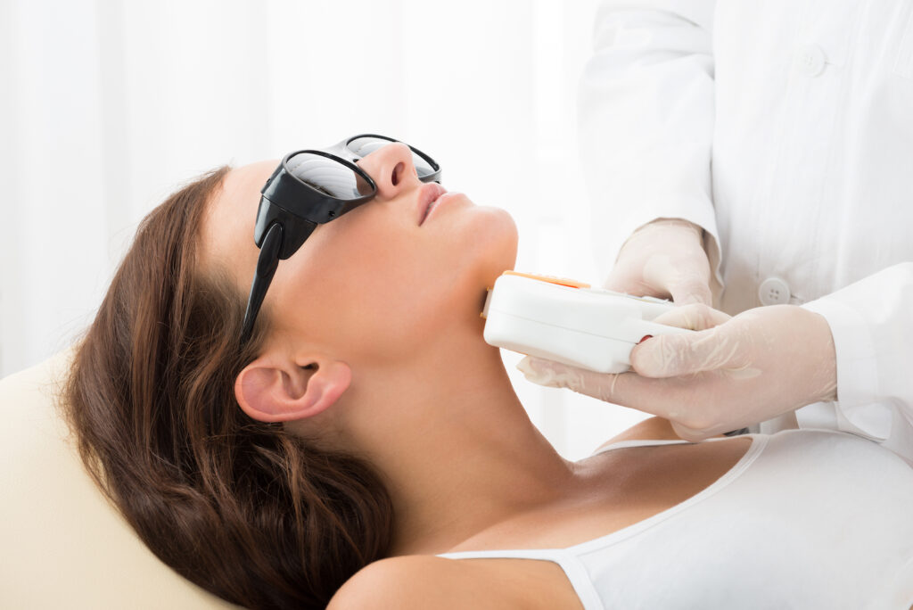 ipl laser ontharing