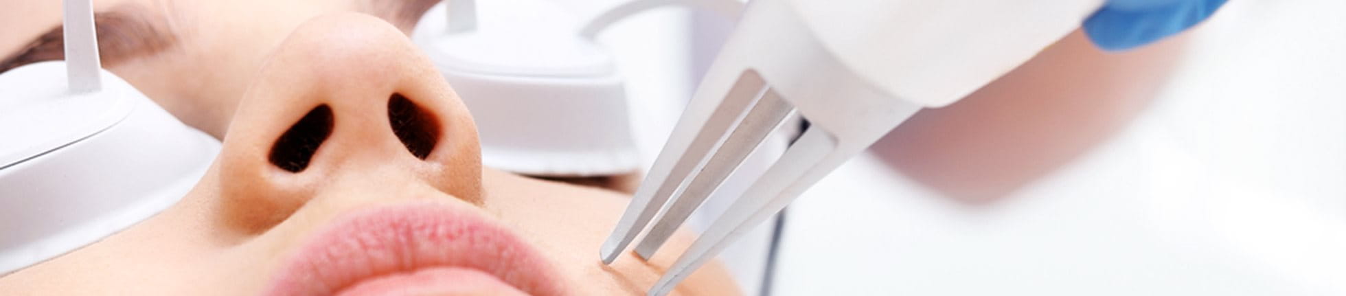 laserbehandeling dermatoloog