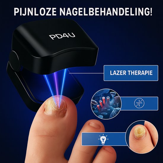 laserbehandeling kalknagels