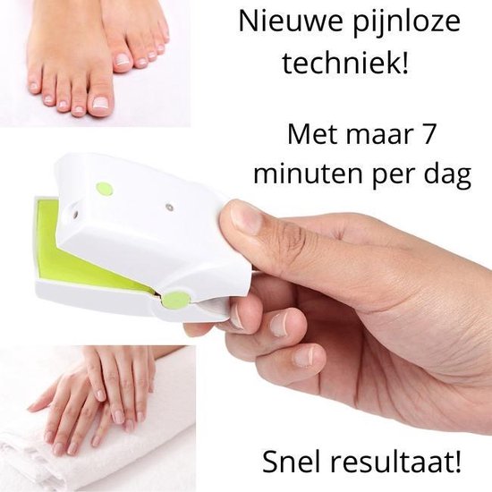 laserbehandeling schimmelnagels